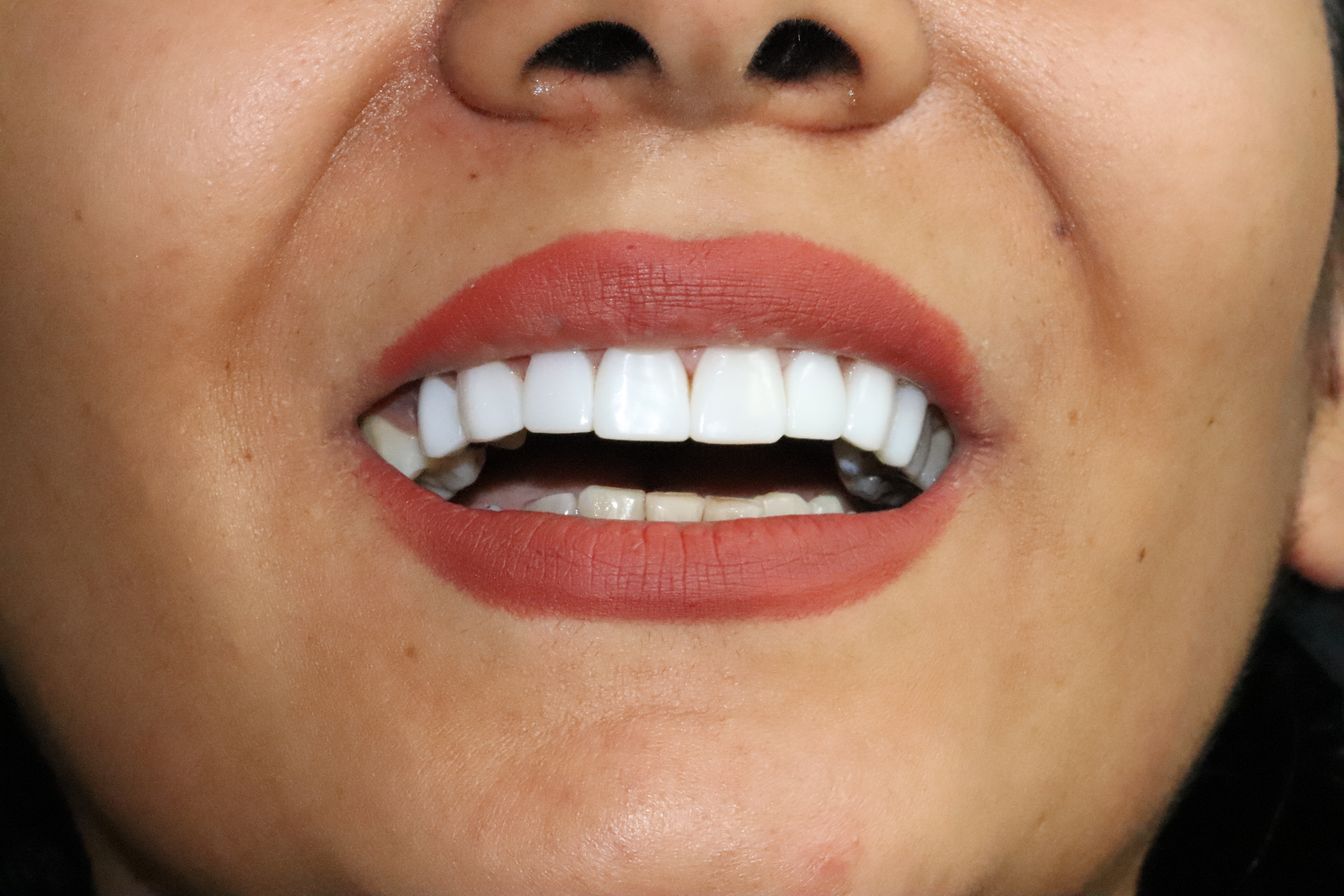 بهترین متخصص ریشه شمال تهران